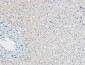 p21 Polyclonal Antibody